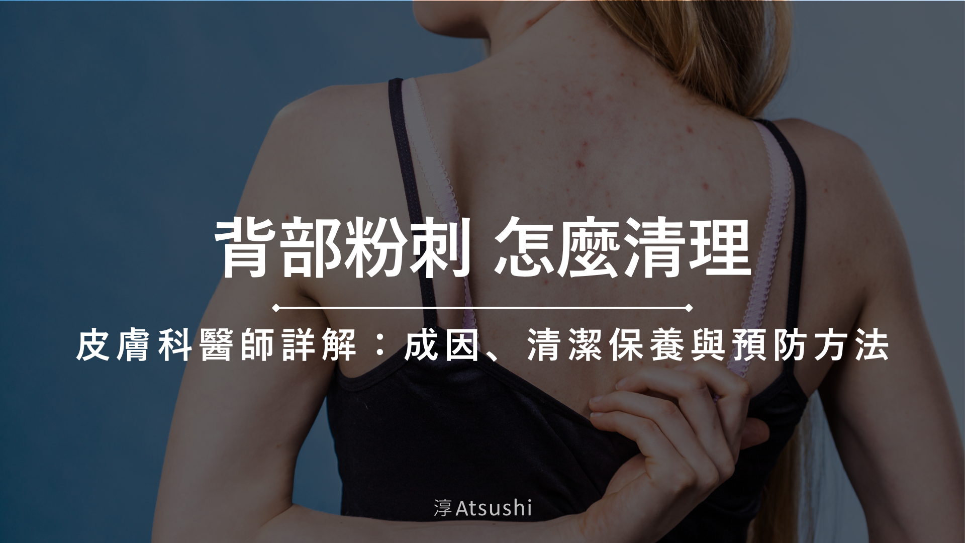 背部粉刺怎麼清理?皮膚科醫師詳解:3大成因、清潔保養與預防方法