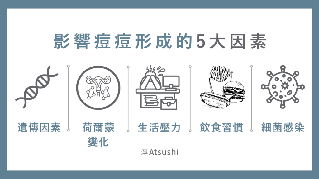 痘痘形成的5大因素